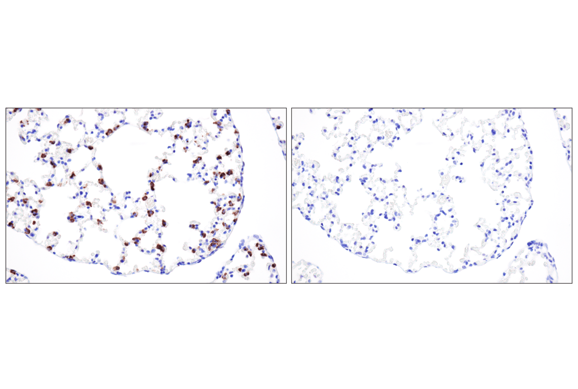 Immunohistochemistry Image 4: LAMP3/CD208 (E8T2T) Rabbit Monoclonal Antibody (BSA and Azide Free)