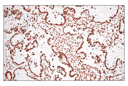 Immunohistochemistry Image 5: PTBP1 (E5O2S) Rabbit Monoclonal Antibody