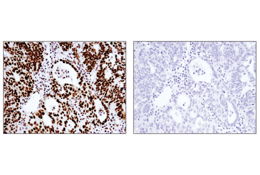 undefined Image 35: BAF Complex IHC Antibody Sampler Kit