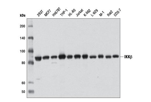 undefined Image 25: NF-κB Pathway Antibody Sampler Kit