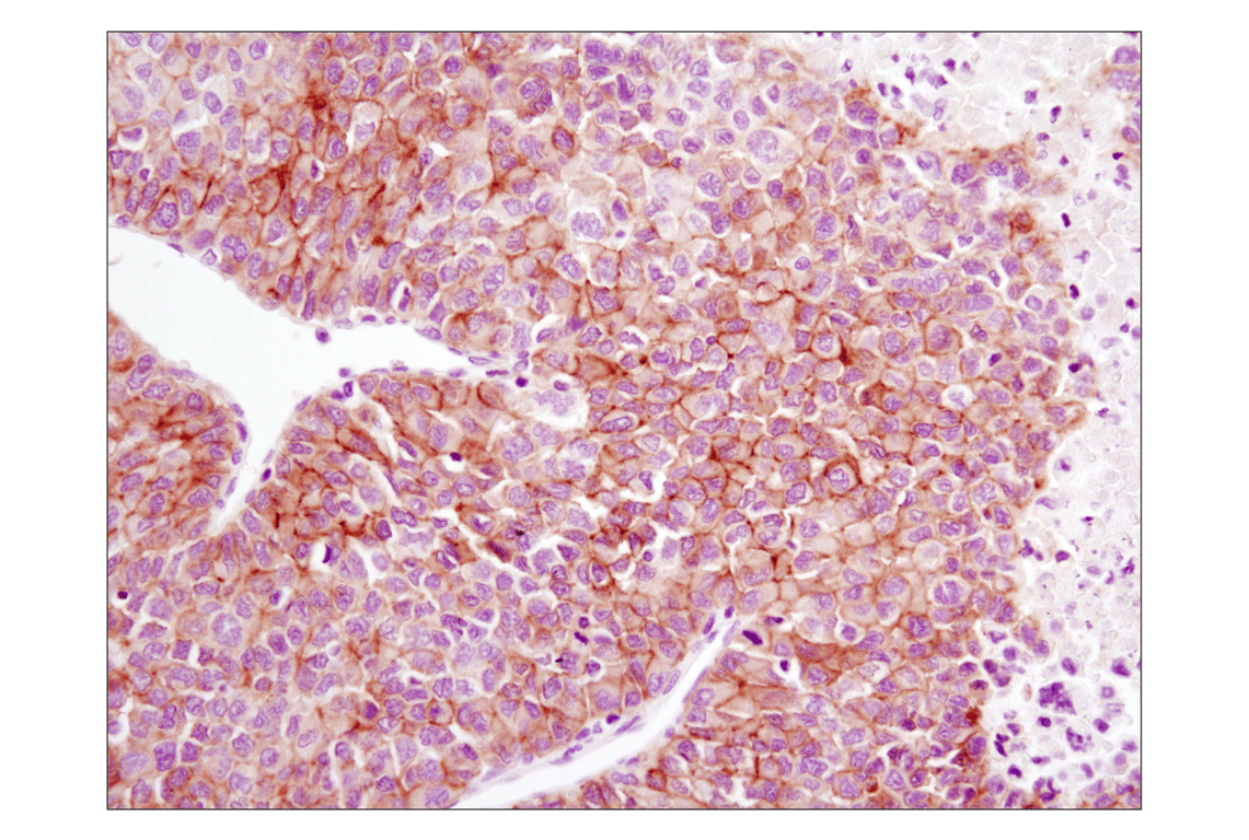 Immunohistochemistry Image 1: EGF Receptor (D38B1) Rabbit Monoclonal Antibody