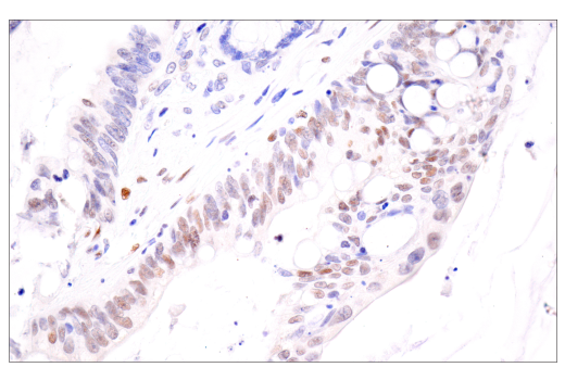 Immunohistochemistry Image 1: HIF-1 alpha (E1V6A) Rabbit Monoclonal Antibody
