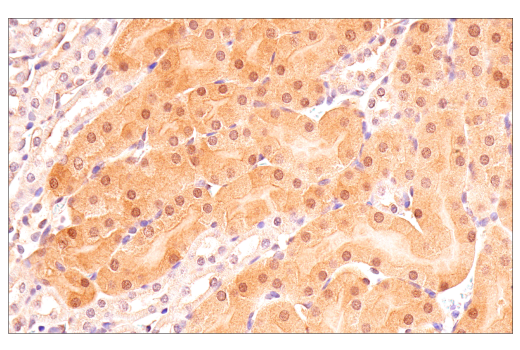Immunohistochemistry Image 7: p70 S6 Kinase (E8K6T) Rabbit Monoclonal Antibody (BSA and Azide Free)