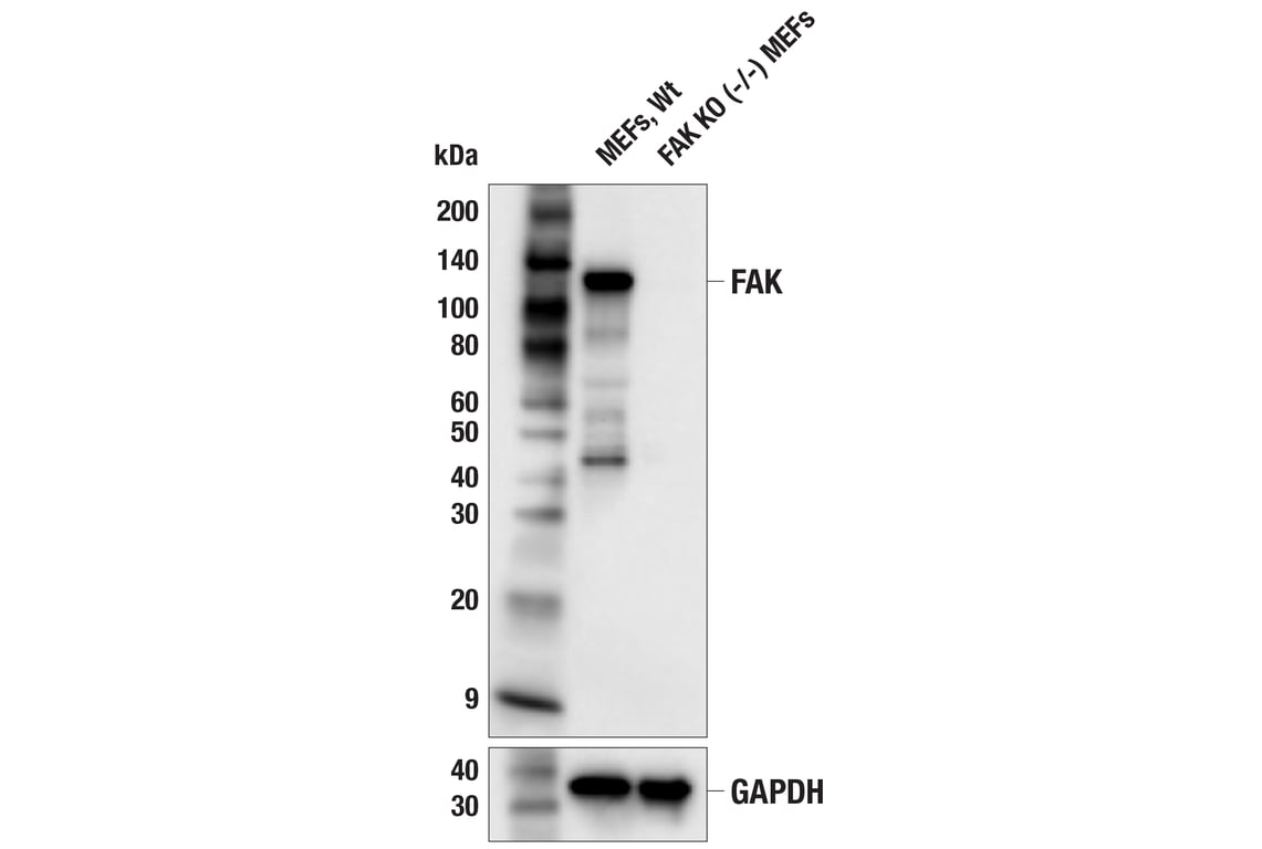 Western Blotting Image 2: FAK (F7Z4C) Mouse Monoclonal Antibody
