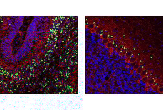 Immunofluorescence Image 1: Sox1 Antibody