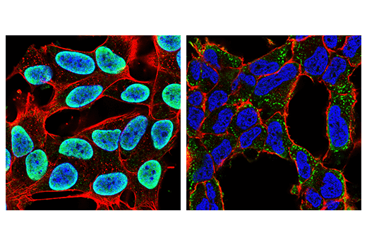 FUS/TLS (E3O8I) Rabbit mAb | Cell Signaling Technology FUS/TLS (E3O8I) Rabbit mAb | Cell Signaling Technology