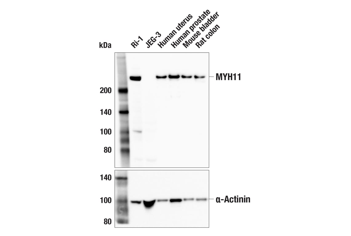 Western Blotting Image 2: MYH11 (E4N8M) Rabbit Monoclonal Antibody (BSA and Azide Free)
