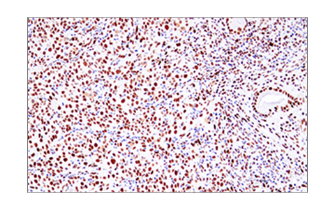 Immunohistochemistry Image 4: 53BP1 (E7N5D) Rabbit Monoclonal Antibody (BSA and Azide Free)