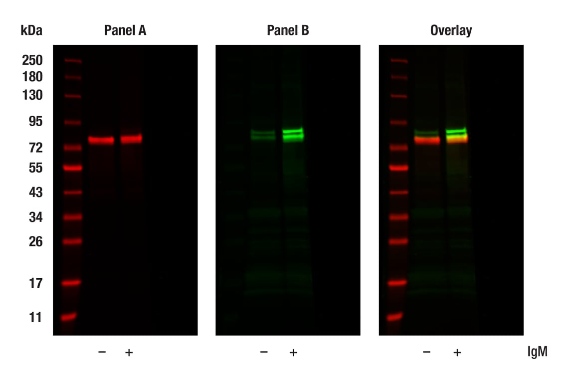 Western Blotting Image 1: Syk (4D10) Mouse Monoclonal Antibody
