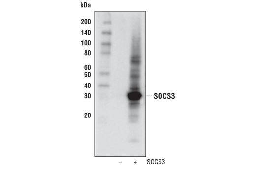 undefined Image 8: Jak/Stat Pathway Inhibitors Antibody Sampler Kit