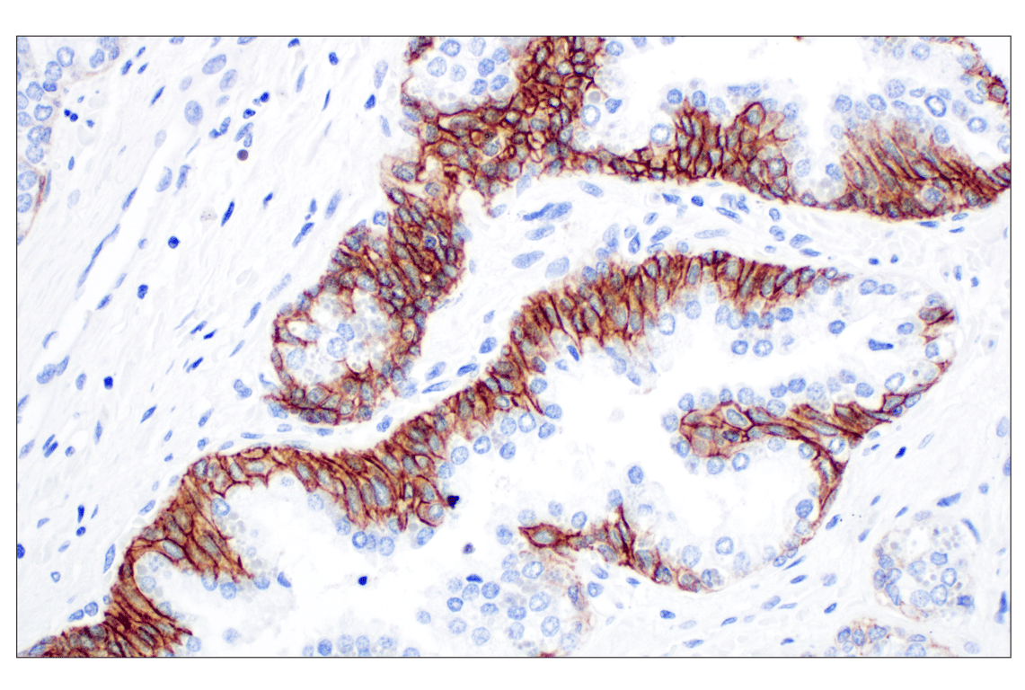 Immunohistochemistry Image 1: CD44 v5 (C44Mab-3) Mouse Monoclonal Antibody