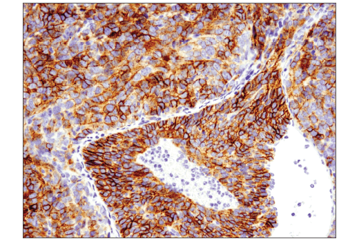 Immunohistochemistry Image 1: EpCAM (E6V8Y) Rabbit Monoclonal Antibody
