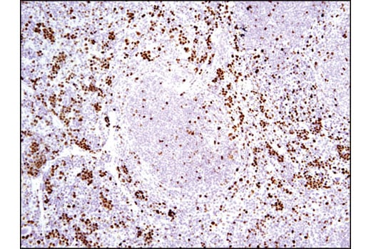 Immunohistochemistry Image 3: Ki-67 (D3B5) Rabbit Monoclonal Antibody (IHC Formulated)