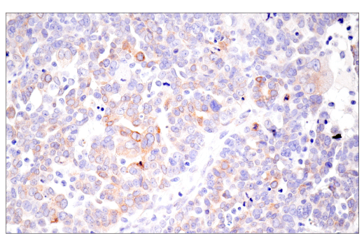 Immunohistochemistry Image 6: CTHRC1 (E8M9S) Rabbit Monoclonal Antibody