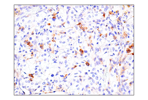 Immunohistochemistry Image 4: Axl (C89E7) Rabbit Monoclonal Antibody (BSA and Azide Free)