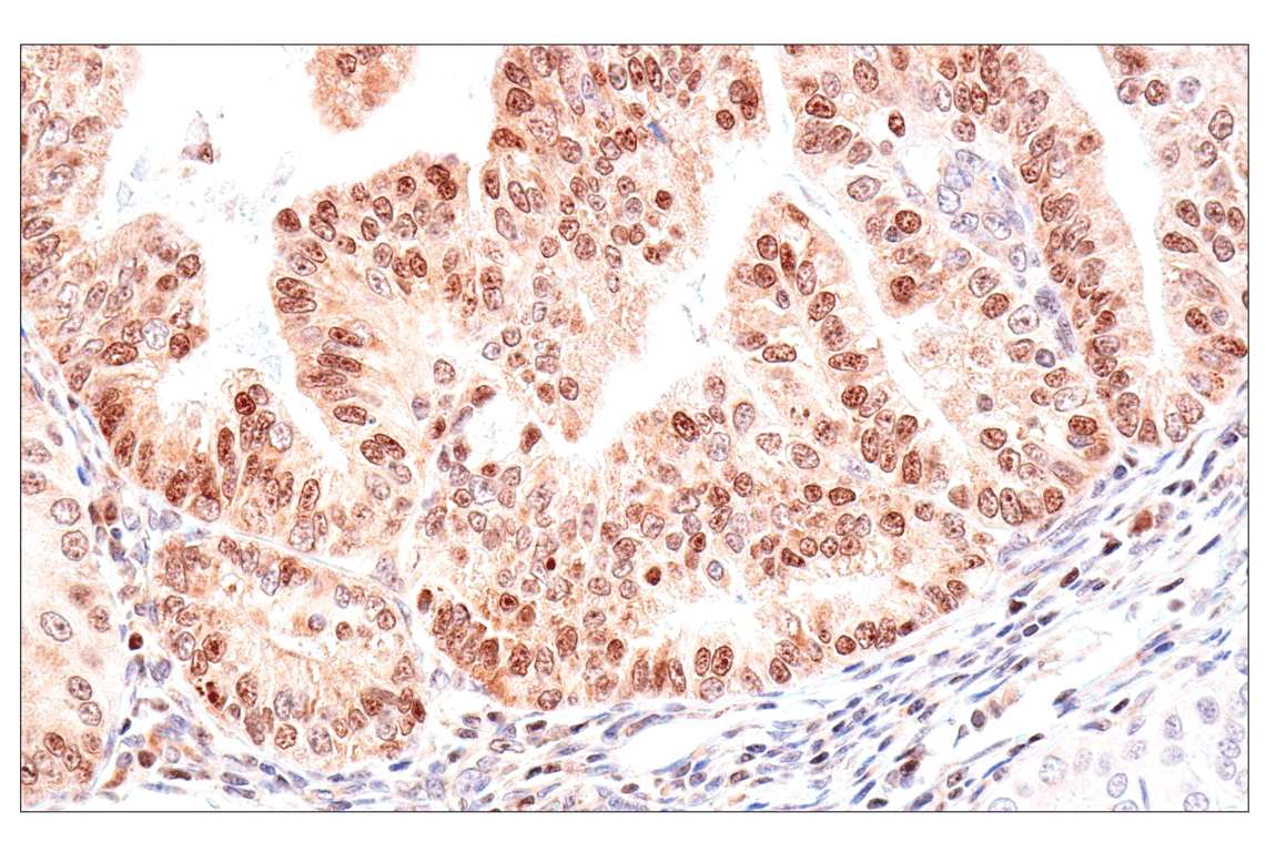 Immunohistochemistry Image 1: ADAR1 p150 Isoform (E6U1U) Rabbit Monoclonal Antibody (BSA and Azide Free)