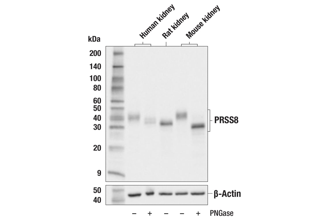 Western Blotting Image 2: PRSS8 (F2Z4K) Rabbit Monoclonal Antibody