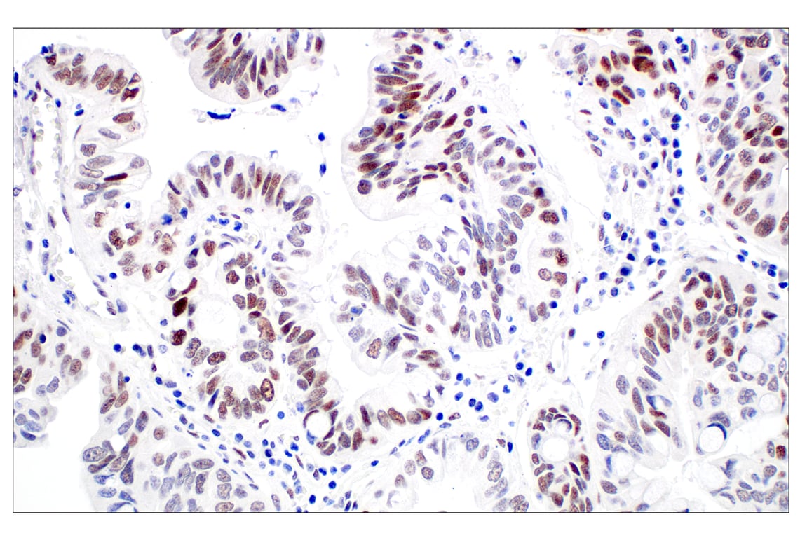 Immunohistochemistry Image 1: TCF12/HEB (E5R8X) Rabbit Monoclonal Antibody