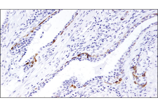 Immunohistochemistry Image 3: TrkA (12G8) Rabbit Monoclonal Antibody (BSA and Azide Free)