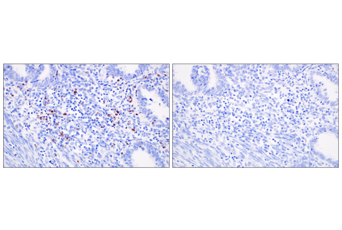 CXCL13 (F6A4R) Rabbit mAb | Cell Signaling Technology
