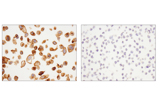 Immunohistochemistry Image 1: RhoB (D1J9V) Rabbit Monoclonal Antibody