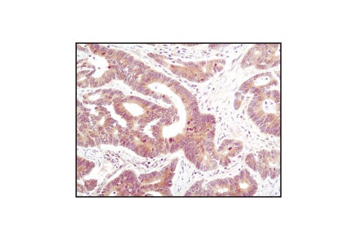 Immunohistochemistry Image 2: PP2C-alpha (D18C10) Rabbit Monoclonal Antibody (BSA and Azide Free)
