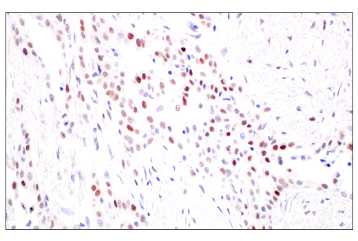 Immunohistochemistry Image 3: p53 (DO-1) Mouse Monoclonal Antibody