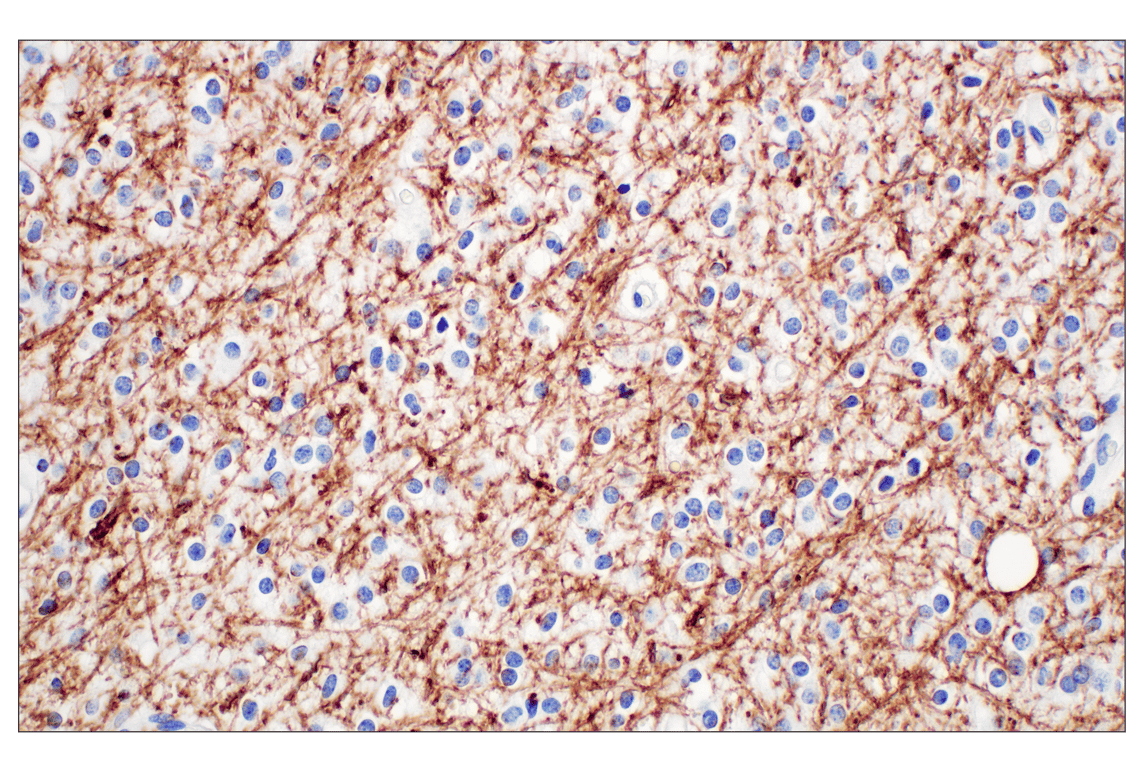 Immunohistochemistry Image 2: PLP1 (E9V1N) Rabbit Monoclonal Antibody (BSA and Azide Free)