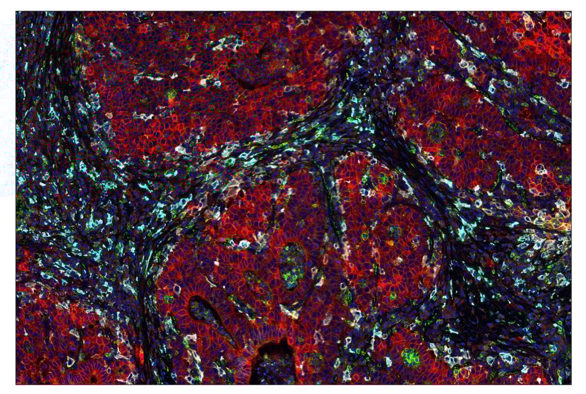 Immunohistochemistry Image 1: CD163 (D6U1J) & CO-0022-594 SignalStar<sup>™</sup> Oligo-Antibody Pair
