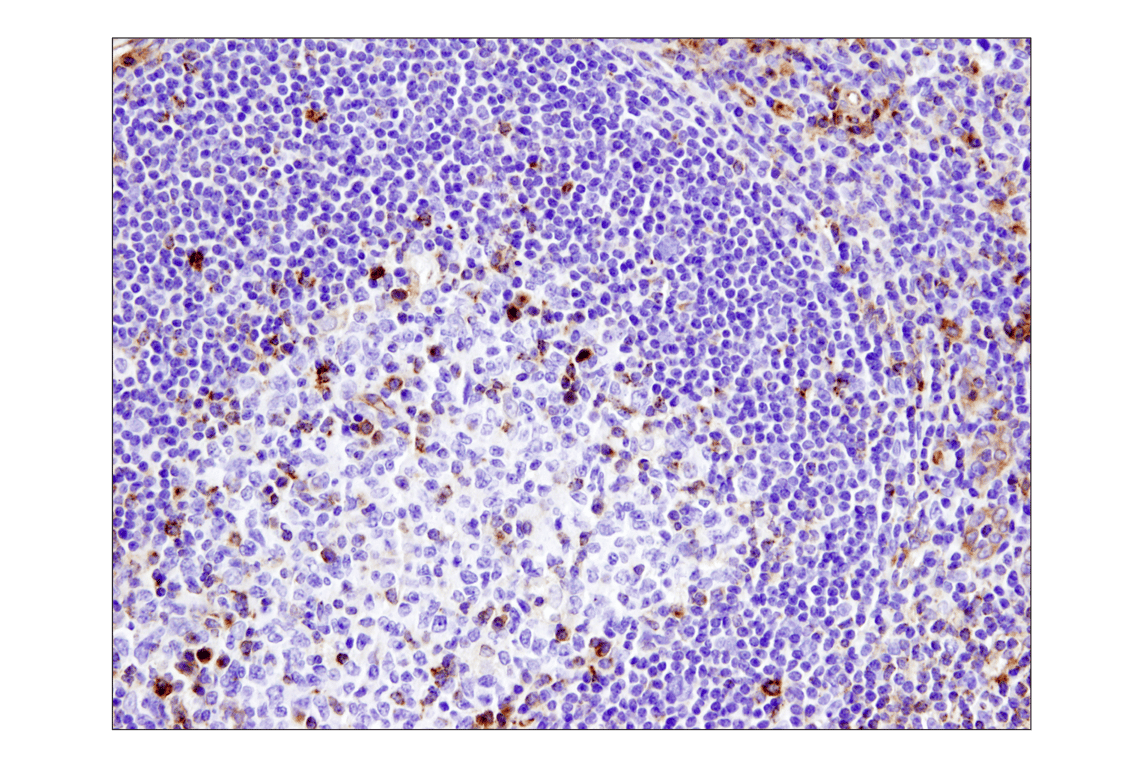 Immunohistochemistry Image 1: VISTA (D1L2G) Rabbit Monoclonal Antibody