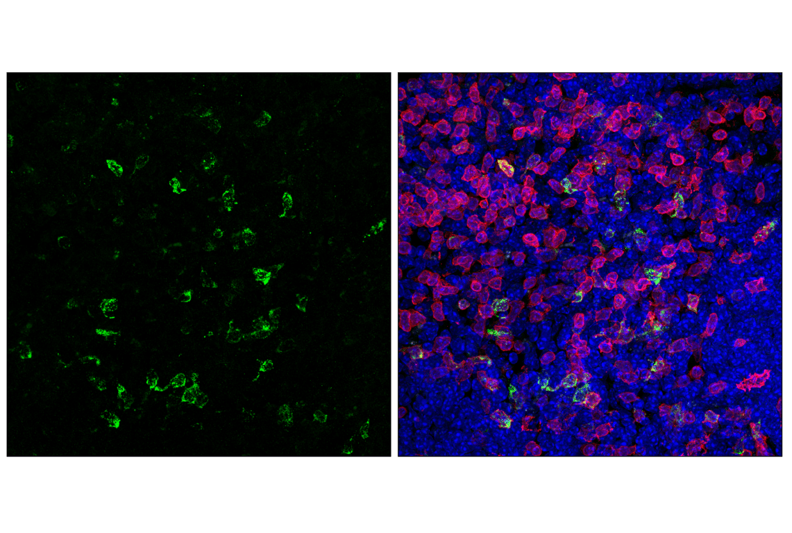 Immunofluorescence Image 2: CTLA-4 (E2V1Z) Rabbit Monoclonal Antibody