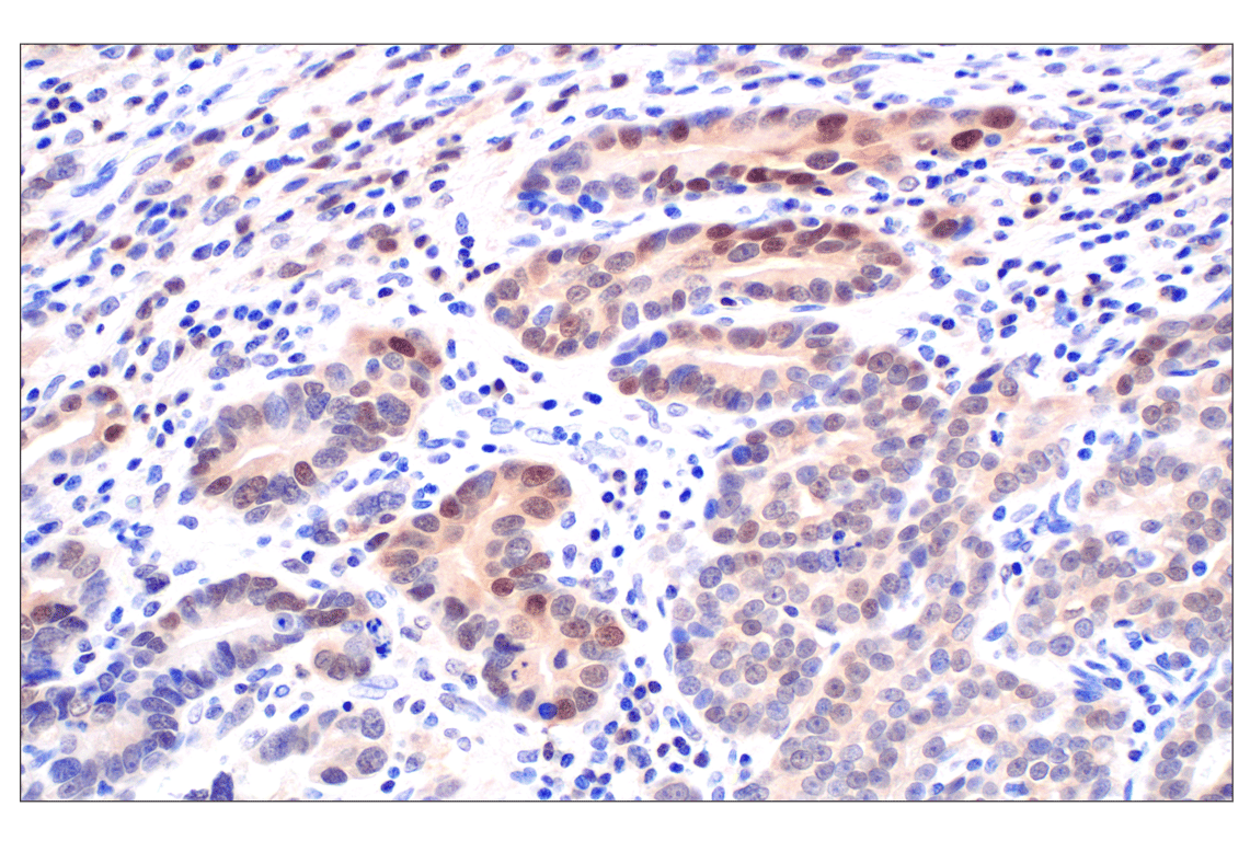 Immunohistochemistry Image 2: CDK6 (E3E3Q) Rabbit Monoclonal Antibody