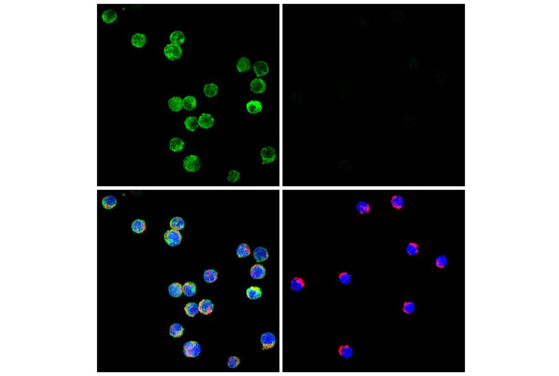 undefined Image 13: PhosphoPlus<sup>®</sup> Btk (Tyr223) Antibody Duet