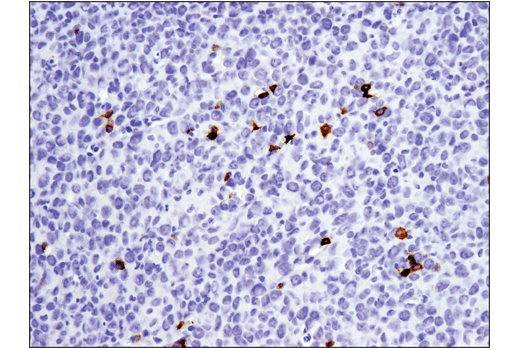 Immunohistochemistry Image 1: PD-1 (Intracellular Domain) (D7D5W) Rabbit Monoclonal Antibody