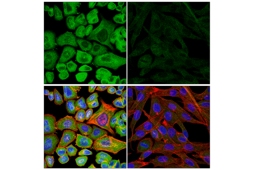 Immunofluorescence Image 1: CaMKII-gamma (E4C3O) Rabbit Monoclonal Antibody
