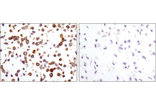 Immunohistochemistry Image 2: CD82 (D7G6H) Rabbit Monoclonal Antibody