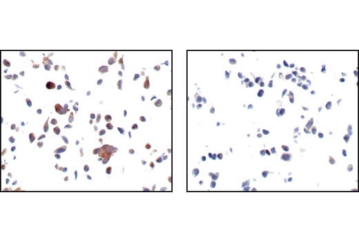 undefined Image 23: Alzheimer's Disease Antibody Sampler Kit