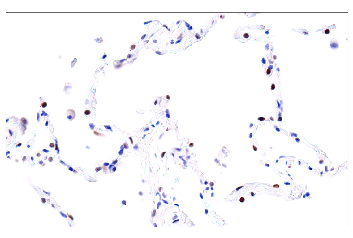 Immunohistochemistry Image 12: GATA-6 (D61E4) Rabbit Monoclonal Antibody