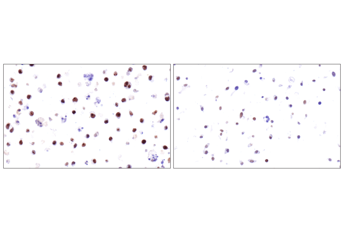 Immunohistochemistry Image 9: ADAR2 (F6U8S) Rabbit Monoclonal Antibody