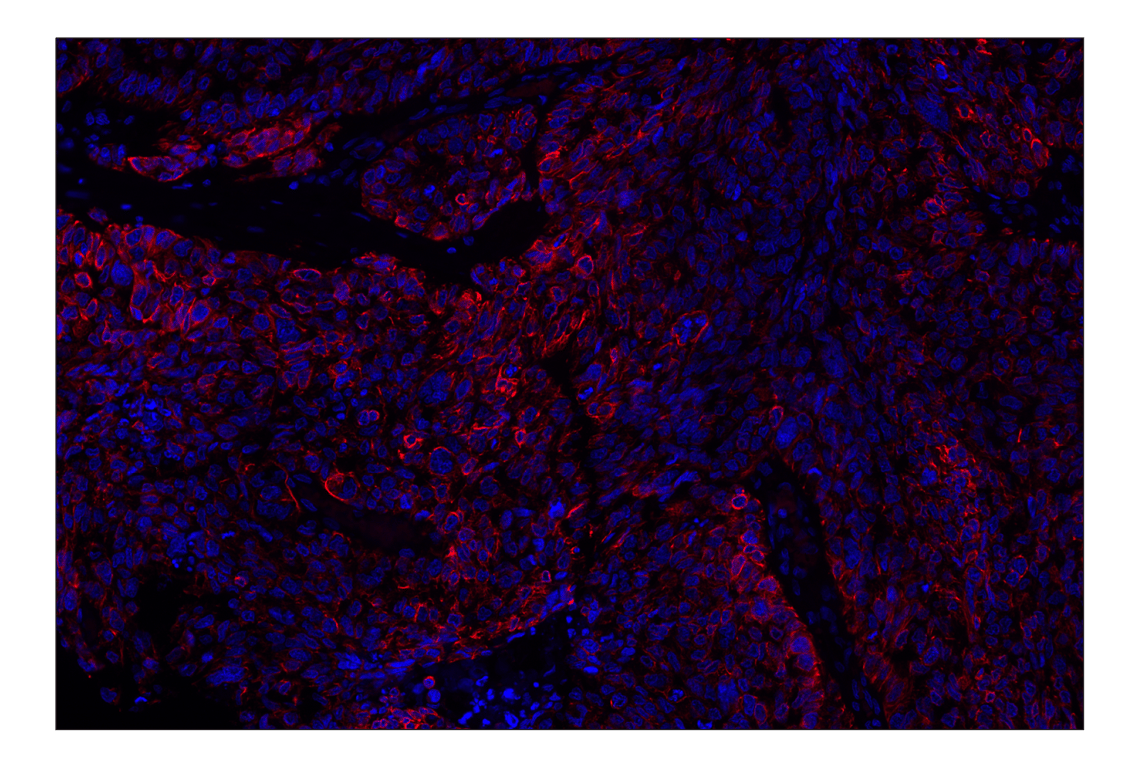 Immunohistochemistry Image 2: Keratin 5 (E2T4B) Rabbit Monoclonal Antibody (Alexa Fluor<sup>®</sup> 555 Conjugate)