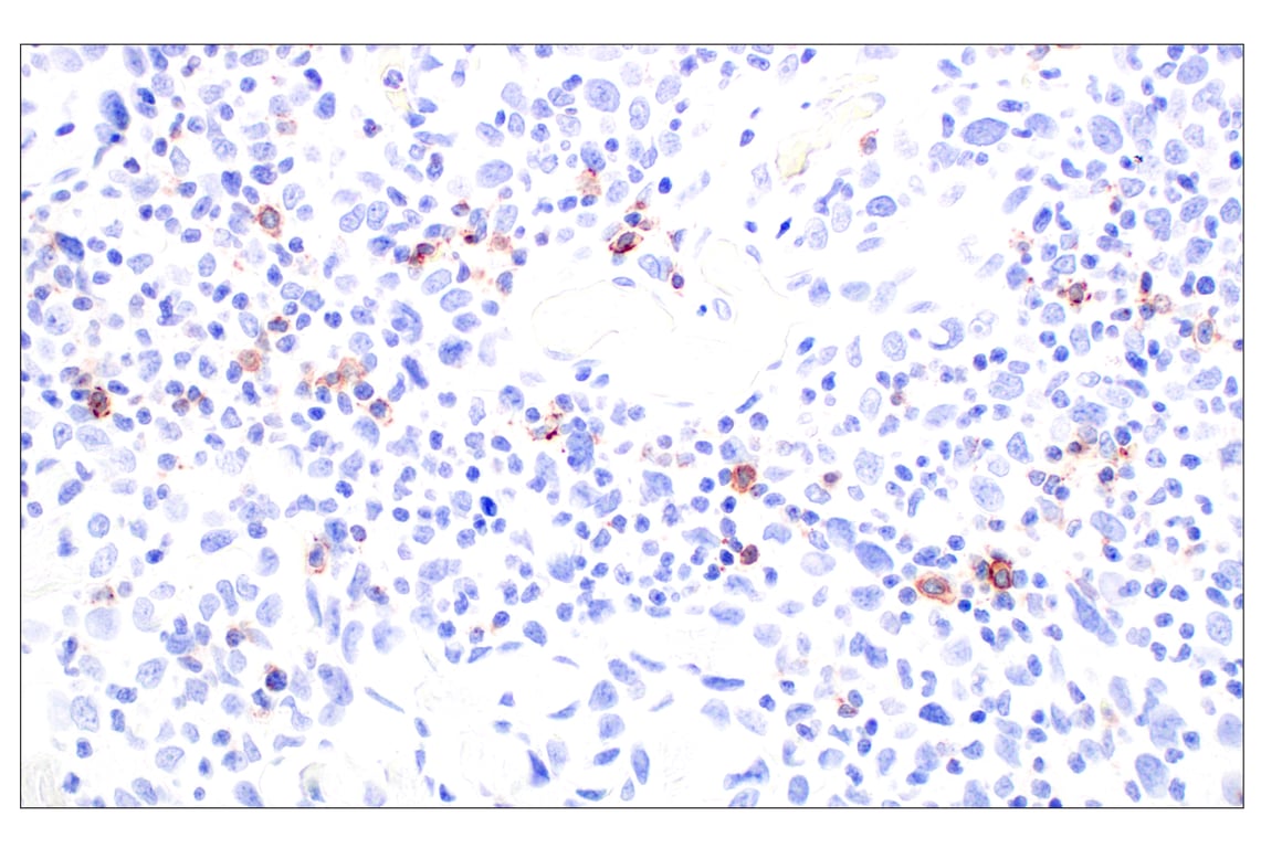 Immunohistochemistry Image 3: CD62L/L-Selectin (E7X9I) Rabbit Monoclonal Antibody (BSA and Azide Free)