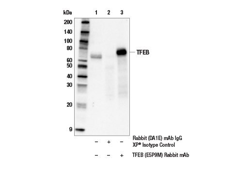Immunoprecipitation Image 1: TFEB (E5P9M) Rabbit Monoclonal Antibody