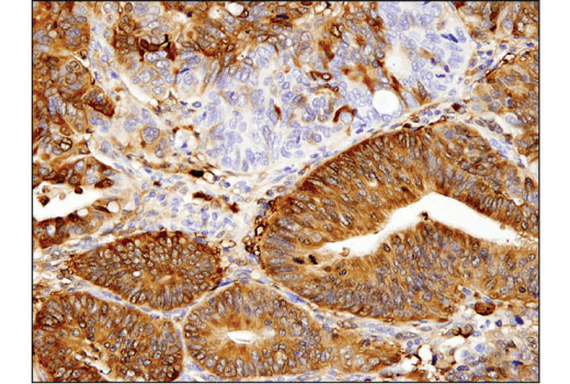 Immunohistochemistry Image 1: ALDH1A1 (D9Q8E) Rabbit Monoclonal Antibody (BSA and Azide Free)