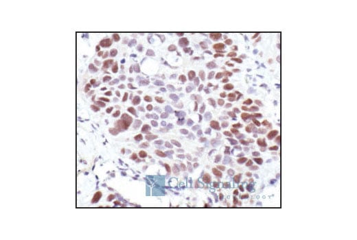 Immunohistochemistry Image 2: Rb (4H1) Mouse mAb