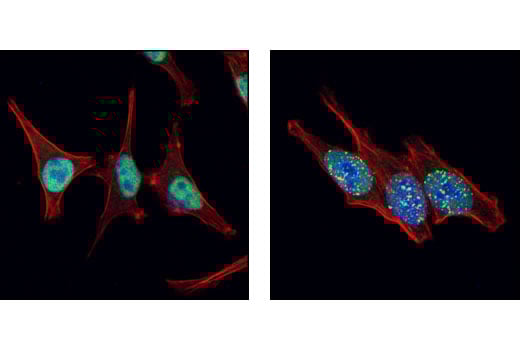 Immunofluorescence Image 1: RPA70/RPA1 Antibody