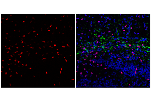 Immunofluorescence Image 1: Olig2 (E6G6Q) Rabbit Monoclonal Antibody (BSA and Azide Free)