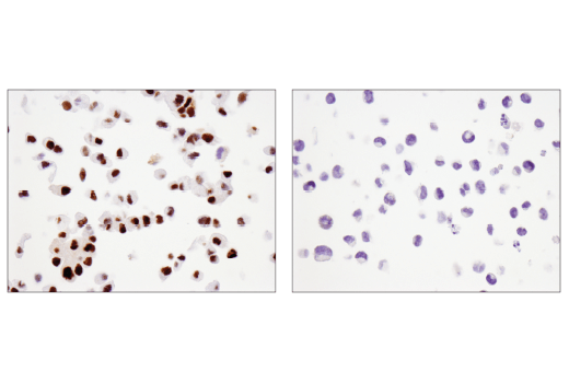 Immunohistochemistry Image 2: SLFN11 (D8W1B) Rabbit Monoclonal Antibody