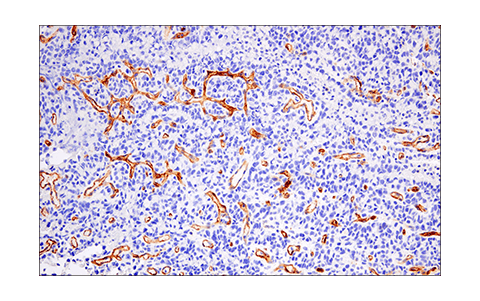 Immunohistochemistry Image 1: CD200 (E5I9V) Rabbit Monoclonal Antibody