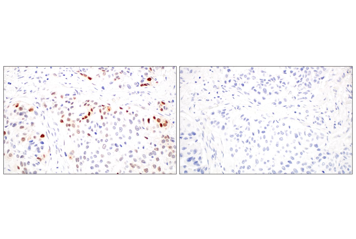 Immunohistochemistry Image 13: ARK5 (E4T2A) Rabbit Monoclonal Antibody
