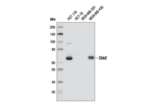 undefined Image 14: ATM Substrates Antibody Sampler Kit